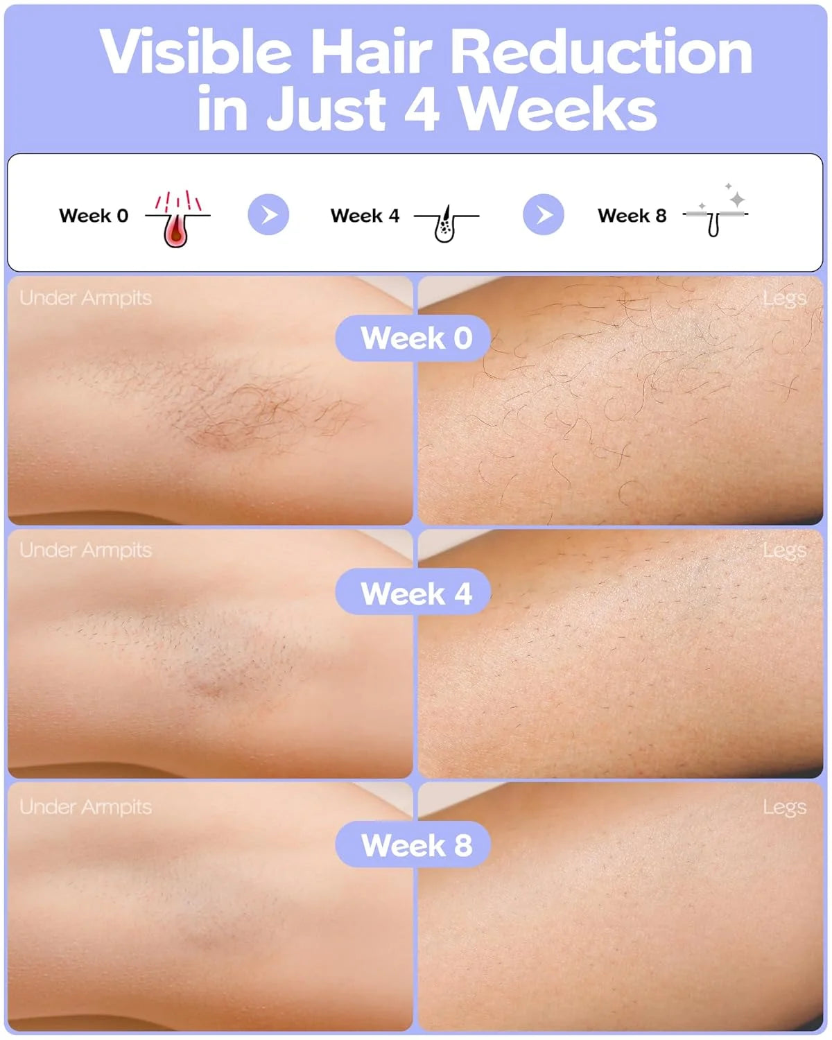 Laser Hair Removal Women Men Cooling System