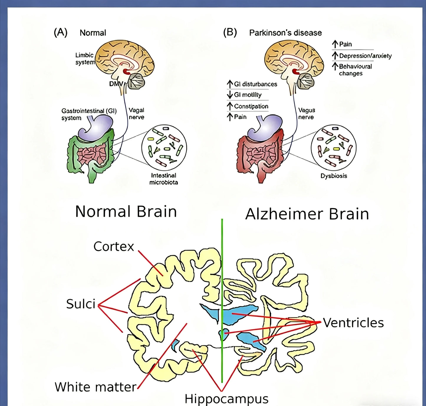 Photobiomodulation Brain Helmet Non-Invasive Infrared Light Therapy