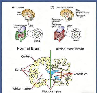 Photobiomodulation Brain Helmet Non-Invasive Infrared Light Therapy