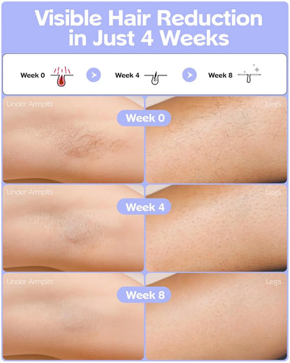 Laser Hair Removal Women Men Cooling System